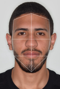 La forma facial indica cuales procedimientos pueden ser más beneficiosos y cuales no para lograr una Armonia Facial 