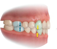 Relacion molar clase I dada por una posible adecuada relación de las estructuras óseas que favorece la Armonia Facial